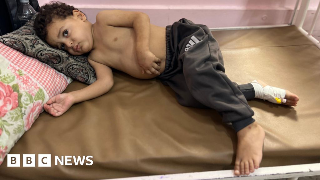 Gaza children dying as they wait for Israel to enable evacuations